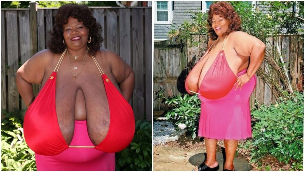 Worlds Biggest Breast Woman 118