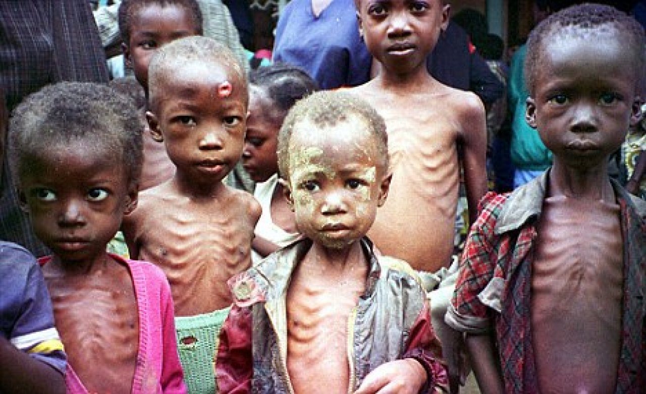 75,000 Children In Nigeria May Die - United Nations
