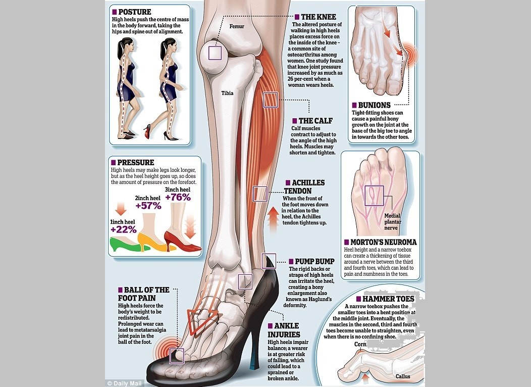 taping toes for heel pain