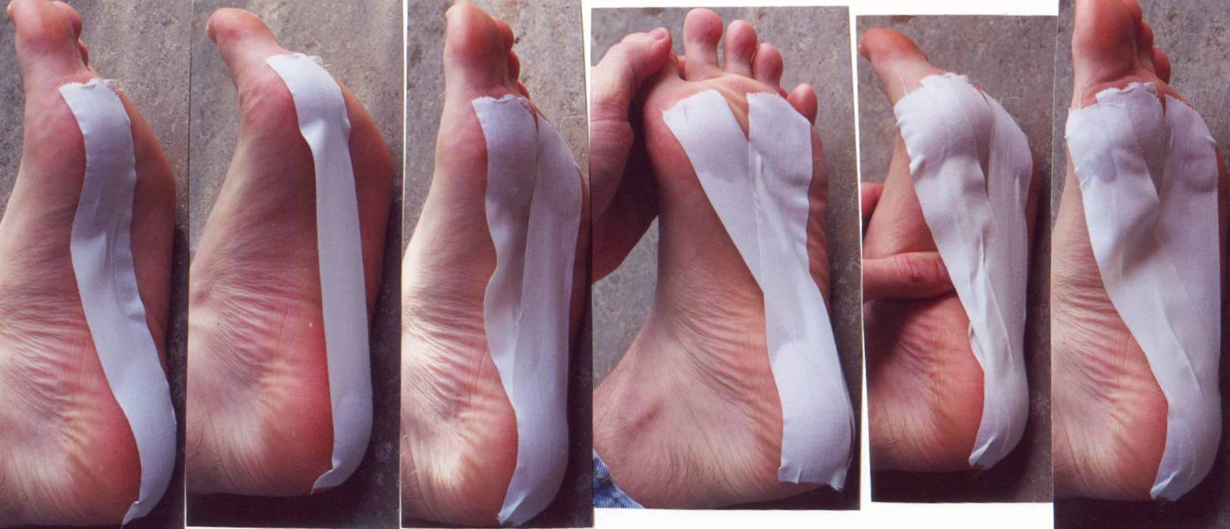 taping toes for heel pain