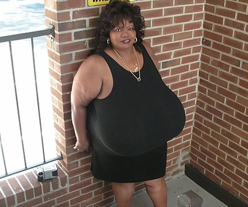 Worlds Biggest Breast Woman 102