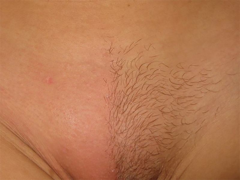 Shaved Pubic Area Pictures 26