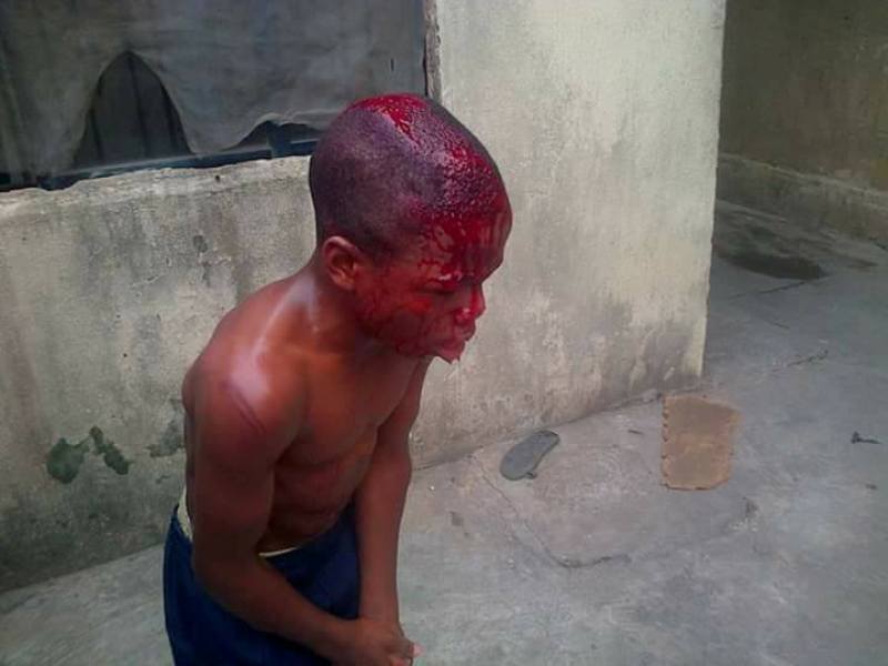 Little Boy Brutally Beaten By His Master For Stealing Money