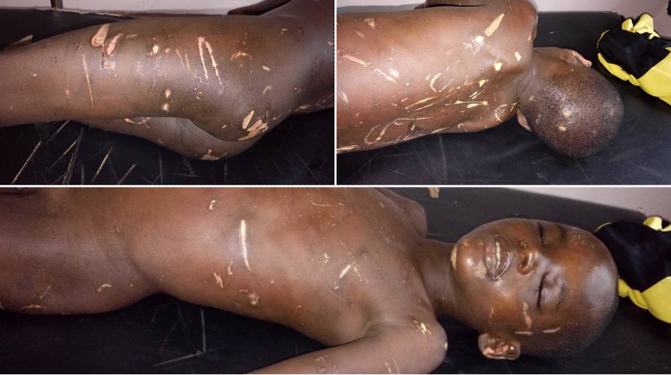 Child Abuse: Father And Step Mum Beat Son To Death In Bayelsa
