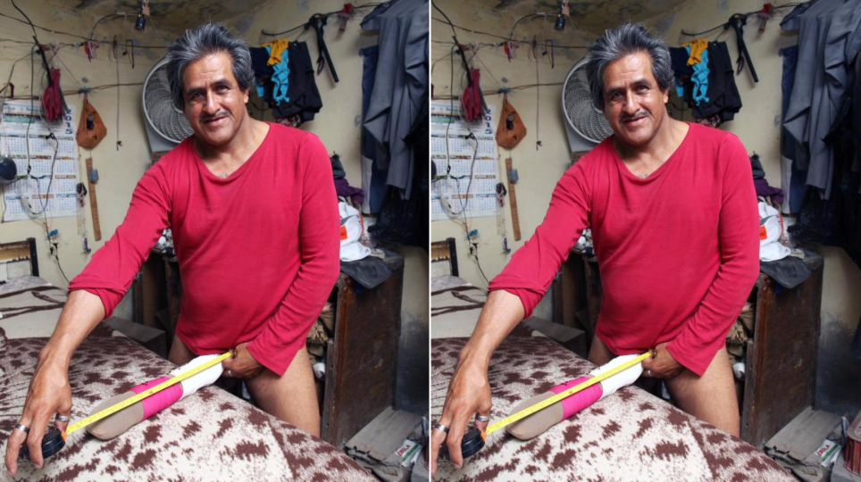 Meet Roberto Esquivel Cabrera, Man With The World's Biggest Penis