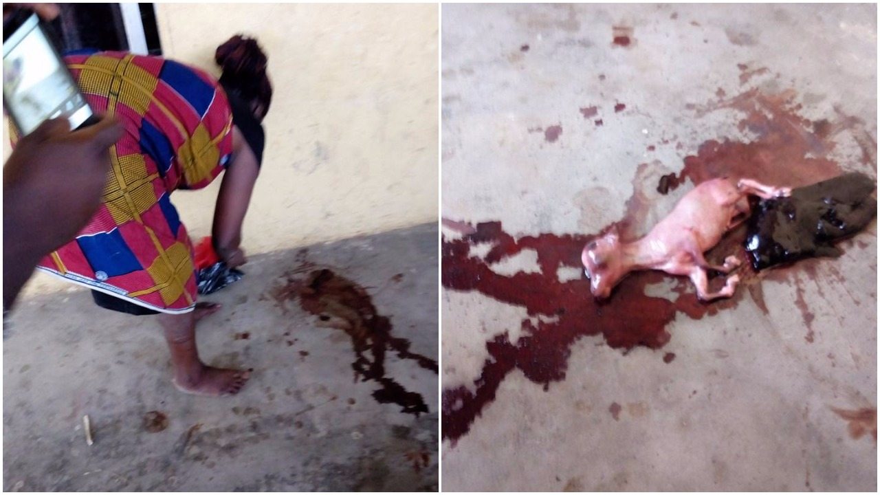 Woman Who Has Been Pregnant For 3 Years Allegedly Delivers A Goat-Like Baby