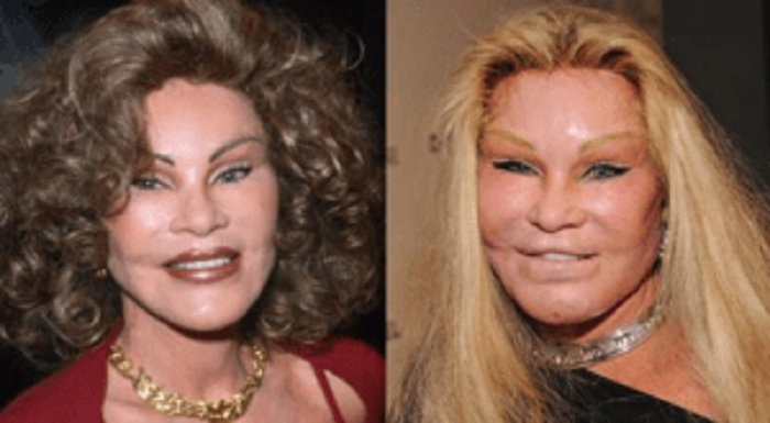 Jocelyn Wildenstein